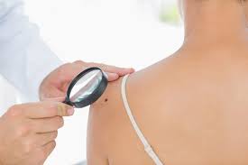 One of the ways aggressive thyroid cancers can become symptomatic is by the local invasion of surrounding structures, including the nerve that controls your vocal chord, says dr. How Do I Know If I Have Skin Cancer Resources Arizona Skin Cancer Surgery Center P C
