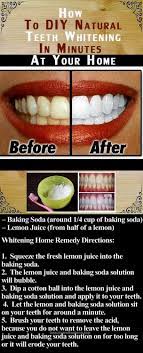 Pin On Natural Teeth Whitening