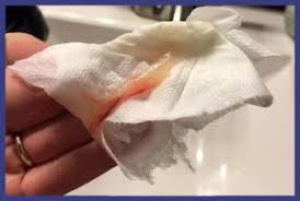 وهذا ما يسمى السدادة المخاطية ويحدث عندما يخرج المخاط الذي كان موجودًا في عنق الرحم خلال فترة الحمل ليسد فتحة عنق الرحم ويحمي الجنين من الإصابة بأي عدوى بكتيرية. Ø®Ù„Ø§Ø· Ù…ÙˆØ³ÙŠÙ‚ÙŠ Ù…ØªØ´Ø§Ø¦Ù… Ø³Ø¯Ø§Ø¯Ø© Ø§Ù„Ø±Ø­Ù… Ø§Ù„Ø³Ø¯Ø§Ø¯Ø© Ø§Ù„Ù…Ø®Ø§Ø·ÙŠØ© Ø¨Ø¯ÙˆÙ† Ø¯Ù… Castello Della Marsiliana Com