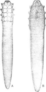 Image result for Demodex folliculorum