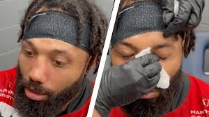 it's still dented isn't it"