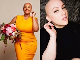4 Women With Alopecia Explain Why Hair Loss Doesn't Define Them