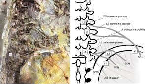 Please use your clinical judgement and note that this is not necessarily standard practice in nz. Anatomical Etiology Of Pseudo Sciatica From Superior Cluneal Nerve E Jpr