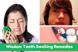 For wisdom teeth swelling caused or exacerbated by pieces of food lodged in the area, rinsing the mouth out with salt water or an oral rinse. How To Get Rid Of Swelling After Wisdom Teeth Removal Arxiusarquitectura