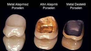Dış cephe kaplamaları ile yalıtım bir maliyet değil ısınma ve soğutma giderlerini % 50 azaltarak tüketiciye hayat boyu tasarruf ve konfor gerçekleştiren bir yatırımdır. Porselen Dis Cesitleri Ve Fiyatlari Nelerdir