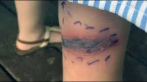 Black widows like to build webs in woodpiles, building overhangs. Black Widow Spider Bite Sends Girl To Hospital 10tv Com