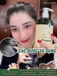 TÓC_TUA_TỦA tơi phồng 𝐯𝐨̛́𝐢 𝐝𝐚̂̀𝐮 𝐠𝐨̣̂𝐢 𝐠𝐮̛̀𝐧𝐠 𝐜𝐚𝐨 𝐜𝐚̂́𝐩  𝐖𝐞𝐢𝐥𝐚𝐢𝐲𝐚 X2 KHẢ NĂNG MỌC TÓC 6 BẰNG SÁNG CHẾ 15 HOẠT CHẤT PEPTIDE ✨  Kích thích mọc toc hiệu quả vượt trội