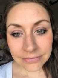 Sebabole: We have people that suffer from bad breath, bad private part  smell, acne, sores, etc… For bad breath and the smell down there 😷 consume  a teaspoon of the powder twice