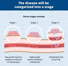 Surgery and chemotherapy combined are the best treatment options. Bone Cancer Osteosarcoma In Dogs Canna Pet