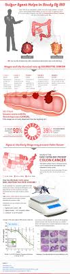 How Sulfur Agents Help In Study Of Ibd Visual Ly Cancer Sign Ibd Study
