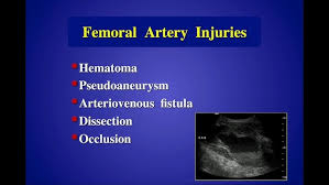 Image result for Pseudoeriosema