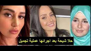 زواج حلا شيحة ومعز مسعود. Ù„Ù† ØªØµØ¯Ù‚ ÙƒÙŠÙ Ø£ØµØ¨Ø­ Ø´ÙƒÙ„ Ø§Ù„ÙÙ†Ø§Ù†Ø© Ø­Ù„Ø§ Ø´ÙŠØ­Ø© Ø¨Ø¹Ø¯ Ø¥Ø¬Ø±Ø§Ø¦Ù‡Ø§ Ø¹Ù…Ù„ÙŠØ© ØªØ¬Ù…ÙŠÙ„ Youtube
