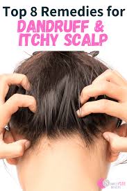 Witch hazel is a natural astringent which helps cure the itchy scalp by reducing the inflammation. Top 8 Natural Home Remedies For Dandruff And Itchy Scalp Simple Pure Beauty