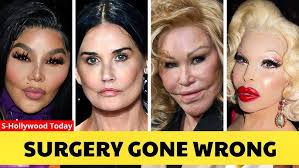 Lori Before and After