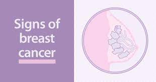 Women may feel discomfort and pain as the cancer grows and spreads in the breast. What Are The Signs Of Breast Cancer Ctca