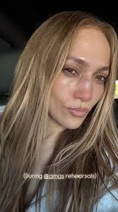 Jennifer Lopez suffers painful facial injury during AMAs 2025 rehearsals