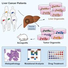Organoid Models Of Human Liver Cancers Derived From Tumor