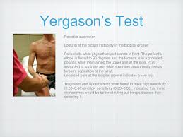 Image result for Yergason Test