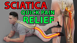 This sciatica exercise provides pain relief by literally flossing a trapped nerve through tight spaces in the back and legs. One Minute Sciatica Exercise To Cure Sciatica Quick Pain Relief Leg Pain Sciatica Disc Bulges Youtube