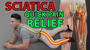 Check spelling or type a new query. One Minute Sciatica Exercise To Cure Sciatica Quick Pain Relief Leg Pain Sciatica Disc Bulges Youtube