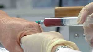 All prp therapy injection procedures are still considered. What Is Prp Injection Is It Worth It The Niche