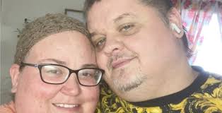 Why does Amy think she needs skin removal surgery? There's no saggy skin.