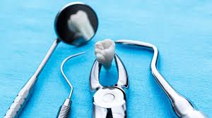 Image result for Tooth Extraction