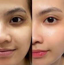 Ada tak silap i. Cuma ada stock atau habis stock + shopee lagi murah. But  if you nak cepat better cari watson 🫶🏻