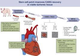 Check spelling or type a new query. Recovery Of Hibernating Myocardium Using Stem Cell Patch With Coronary Bypass Surgery The Journal Of Thoracic And Cardiovascular Surgery