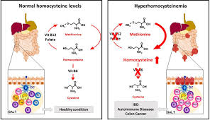 Image result for Homocysteine