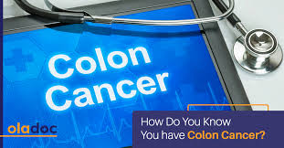 How does the doctor know i have colorectal cancer? How Do You Know You Have Colon Cancer Cancer Care Oladoc Com