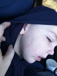 Profile for Casen's Journey