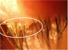 Image result for Blepharis buchneri