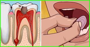 18 effective home remes for tooth ache