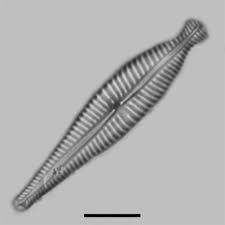 Image result for Strephonema