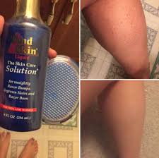 You can have a smooth shave and no razor. This Magical Product Will End Ingrown Hairs And Razor Bumps For Good