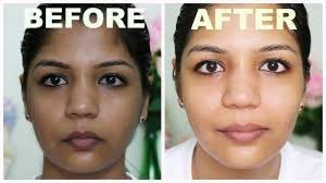 Genuine Black And White Bleaching Cream Before And After For This You Need 3 Tbsp Of Sugar 4 Tbsp Of Baking Soda 2 Tbsp Of Almond Oil First Add All These Now Add 3 Tbsp Skin Bleaching Bleaching Your Skin Lighten Skin