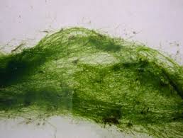 Is a uv pond filter the best choice for my pond? Preventing String Algae Growth In Your Garden Pond