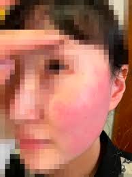 벨기에 대사관은 지난주 초부터 a 씨가 뇌경색으로 병원에 입원 중이라며 대사관은 a 씨가 건강을 빨리 회복해 조만간 경찰 조사에 응하길 바란다라고. Ngi Zz Afq1lgm