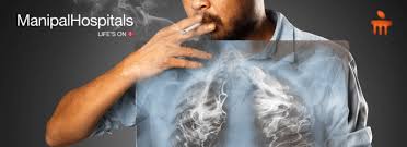 Males and females experience very similar symptoms of lung cancer, which can include 9 Steps To Reduce The Risk Of Lung Cancer Manipal Hospitals Blog