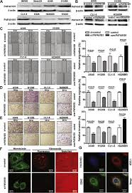 Breast cancer advocates absolutely own the color pink. Overexpression Of Pafah1b1 Is Associated With Tumor Metastasis And Poor Survival In Non Small Cell Lung Cancer Lung Cancer