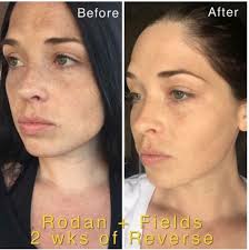 BeautyBio R45 The Reversal The product is a multi-phase retinol treatment  system designed to address signs of aging. It uses a patented 3-phase  system to gradually increase retinol concentration over a 45-day