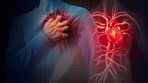Heart Attack Symptoms: 5 warning signs of a heart attack that can appear a  month before | - Times of India