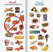 Foods You Can And Can T Have With Braces Getting Braces Braces Food Orthodontics Braces