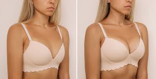 Image result for Breast Augmentation