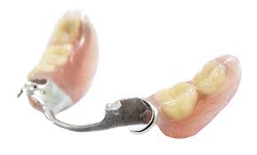 Cela fait partie de la doléance la plus récurrente.en effet si le relief de la crête osseuse est quasi inexistente,la prothèse la mieux réalisée ne pourra jamais avoir une adhérence ma prothese du bas ne tient pas.que faire?. L Adaptation A Une Nouvelle Prothese Dentaire Bucco