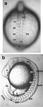 Tell a friend about us, add a link to this page, or visit the webmaster's page for free fun content. Figure 1 From A Notch Feeling Of Somite Segmentation And Beyond Semantic Scholar