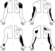 Somatic Referred Pain Springerlink