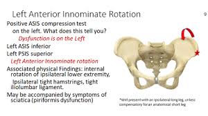 Image result for Pelvic Compression Test