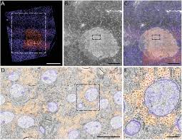 Bias temperature instability is a shift in threshold voltage with applied stress. Optimization Of Negative Stage Bias Potential For Faster Imaging In Large Scale Electron Microscopy Biorxiv